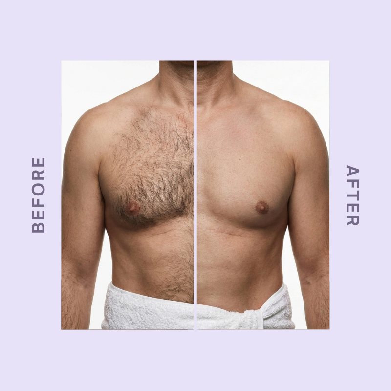 CloudSense Hair Removal Mousse