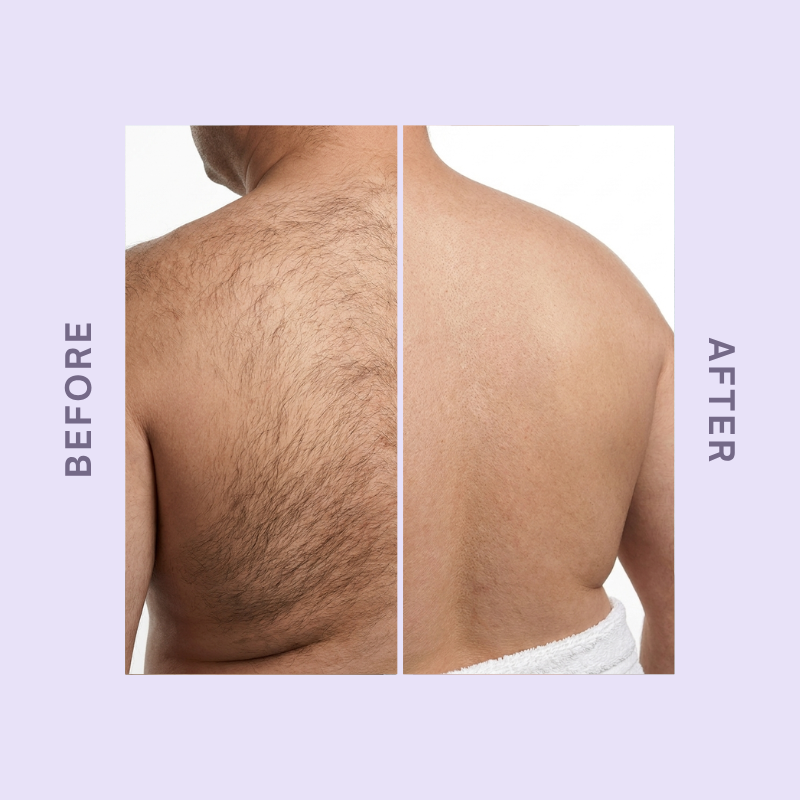 CloudSense Hair Removal Mousse