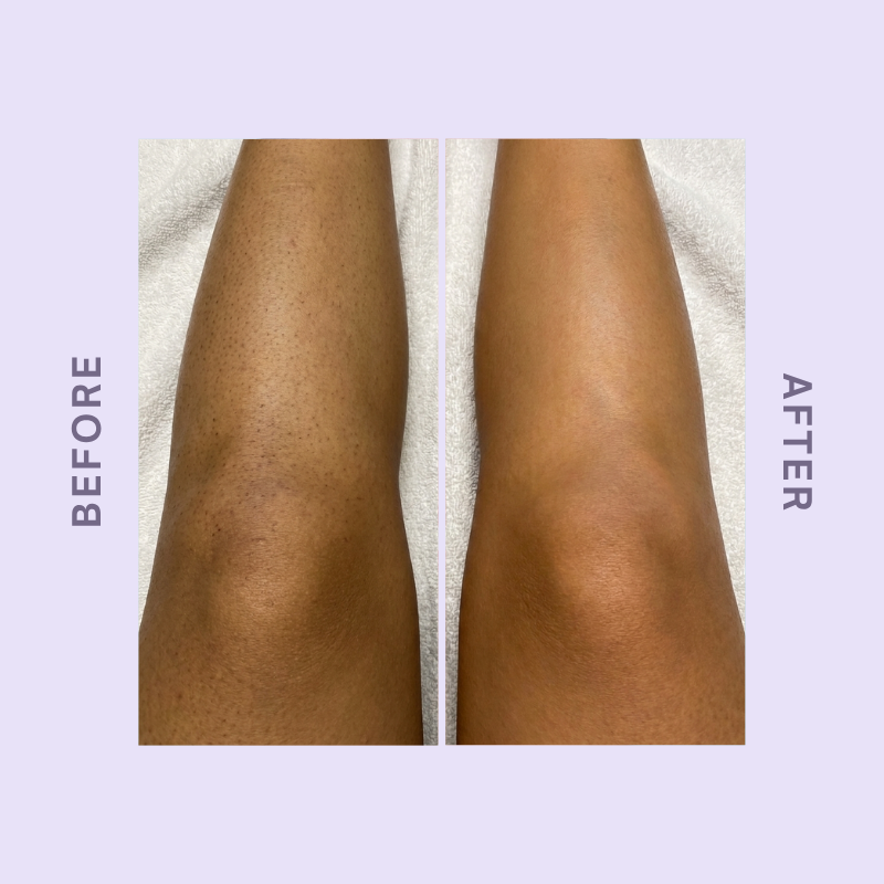 CloudSense Hair Removal Mousse