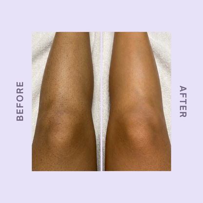 CloudSense Hair Removal Mousse